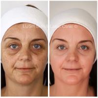 Lush Skin And Laser Clinic Shepparton image 2